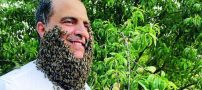 240 هزار نیش زنبور روی صورت این مرد عجیب + عکس