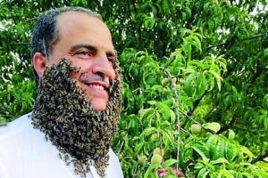 240 هزار نیش زنبور روی صورت این مرد عجیب + عکس