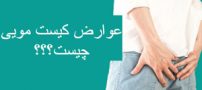 کیست مویی|علائم، عوارض، عکس و روشهای درمان خانگی