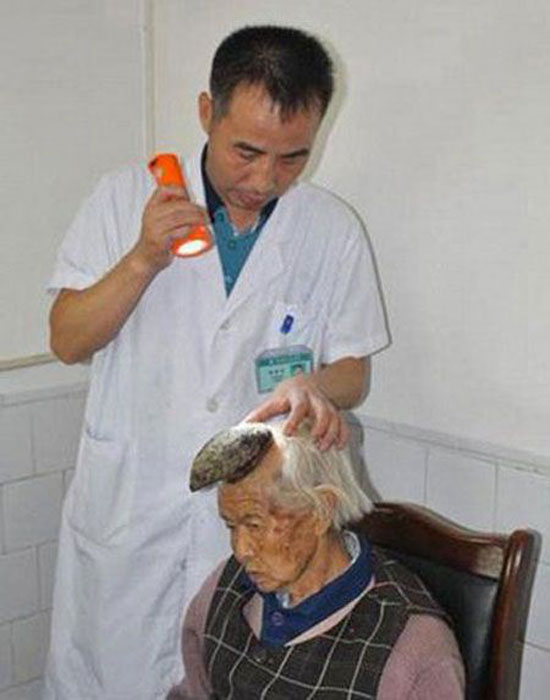 زن 90 ساله ای که به شکل کرگدن است + عکس
