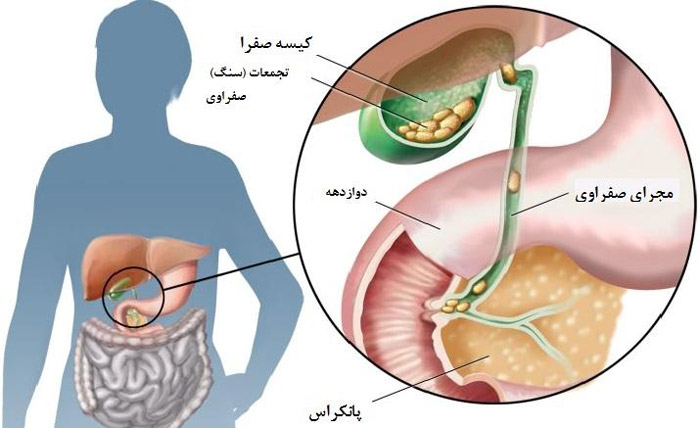 عارضه ی چیست؟