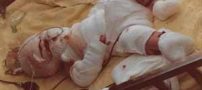 نجات معجزه آسا نوزادی در روغن داغ در حال سرخ شدن! عکس 16+