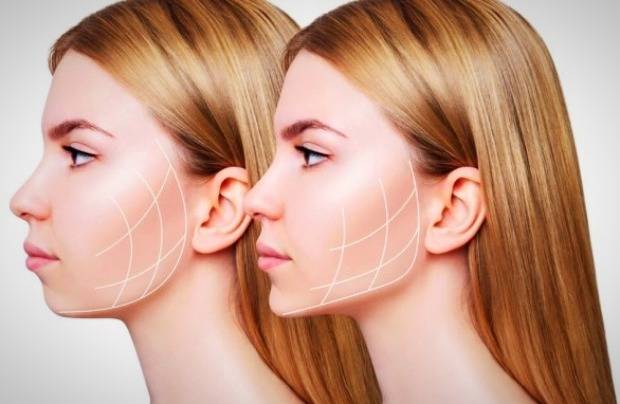عمل زیبایی این بازیگر زن مشهور ترک چیست؟