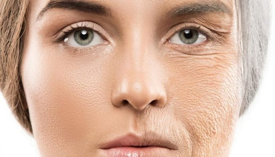 روش های واقعی از بین بردن چین و چروک پوست
