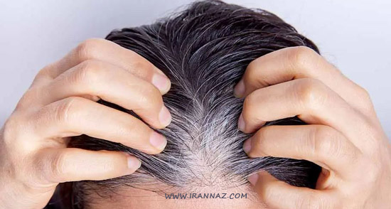 رفع سفیدی موها با استفاده از سیب زمینی رفع سفیدی موها با استفاده از سیب زمینی