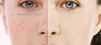 خوراکی های مفید برای داشتن پوست شفاف
