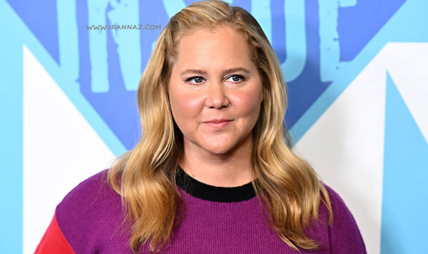 ایمی شومر - Amy Schumer ، بازیگرانی که به خاطر چهره نتوانستند بازی کنند