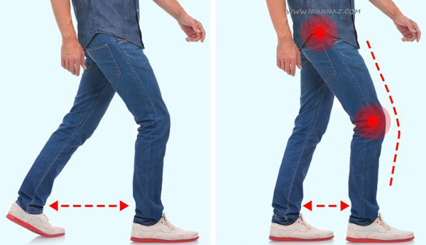 قدم های کوتاه ، این مدل های راه رفتن نشانه بیماری شماست