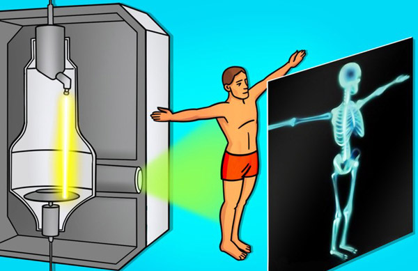 رادیوگرافی - Radiography
