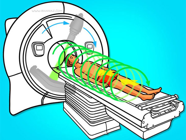 سی تی اسکن - CT Scan
