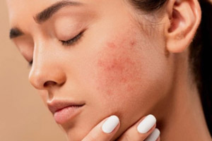 بهترین راهنما برای بیمارهای شایع پوستی