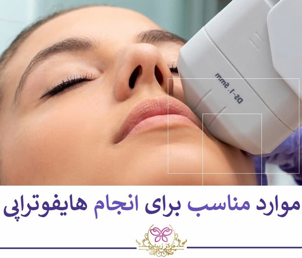 hifu هایفوتراپی در تهران