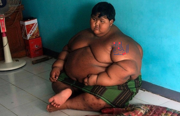 آریا پرمانا - Arya Permana نوجوانی با 191 کیلوگرم وزن از اندونزی ، تصمیمی که زندگی چاق ترین پسر دنیا را تغییر داد