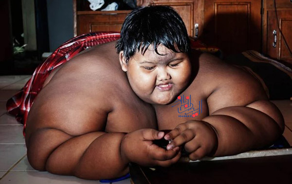 این پسر عنوان چاق ترین پسر دنیا را به دست آورد