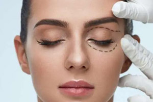 مراحل، انواع، مزایا و معایب بلفاروپلاستی