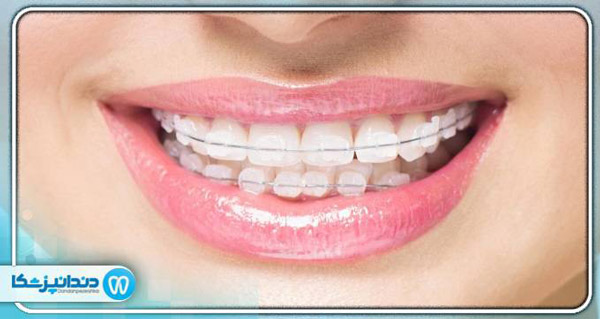 ارتودنسی چیست؟