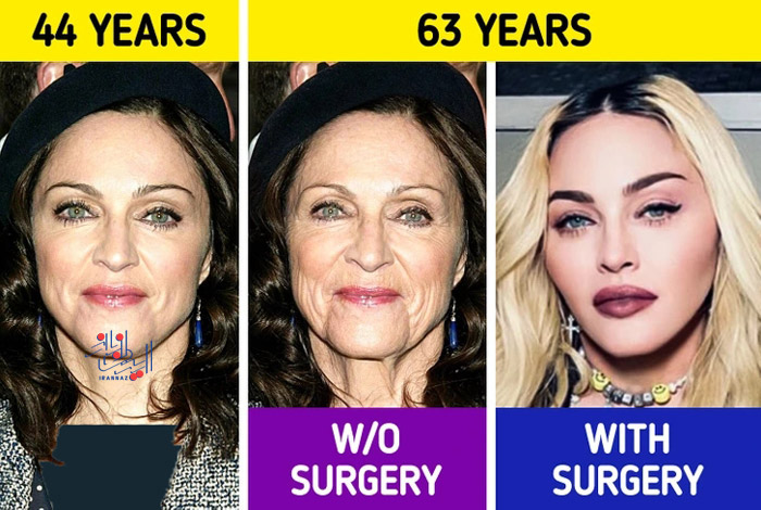 مدونا - Madonna ، اگر بازیگران بدون درمان و جراحی زیبایی پیر می شدند