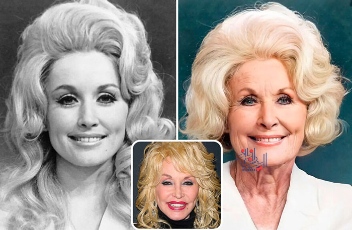 چرا دالی پارتن - Dolly Parton کلاه گیس می گذارد؟