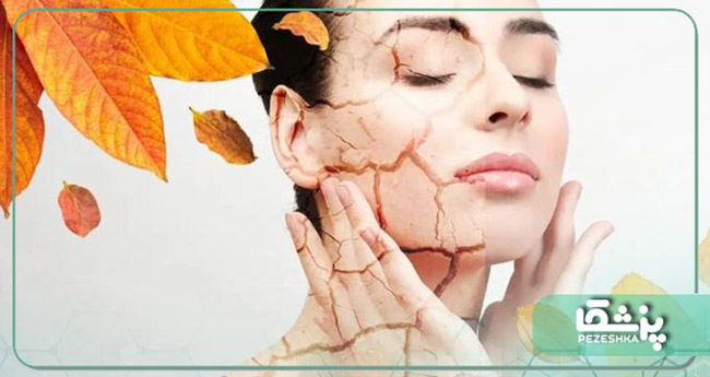 چگونه در زمستان و سرما از پوست خود مراقبت کنیم؟ ❤️