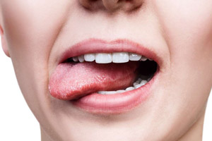 طعم های مختلف در دهان نشانه و علامت چیست؟