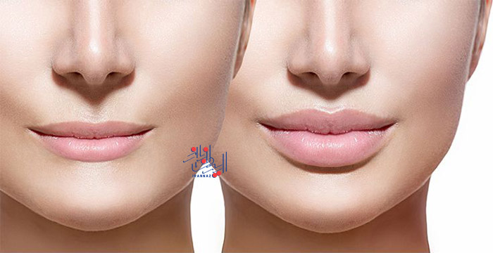 روش های ساده برای حجیم کردن لب ها ، Simple ways to plump up lips