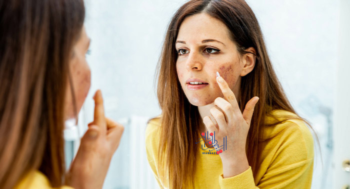 وجود این علائم روی صورت را جدی بگیرید ، Take the presence of these signs on the face seriously