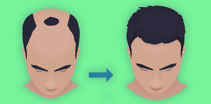 زمان بهبودی