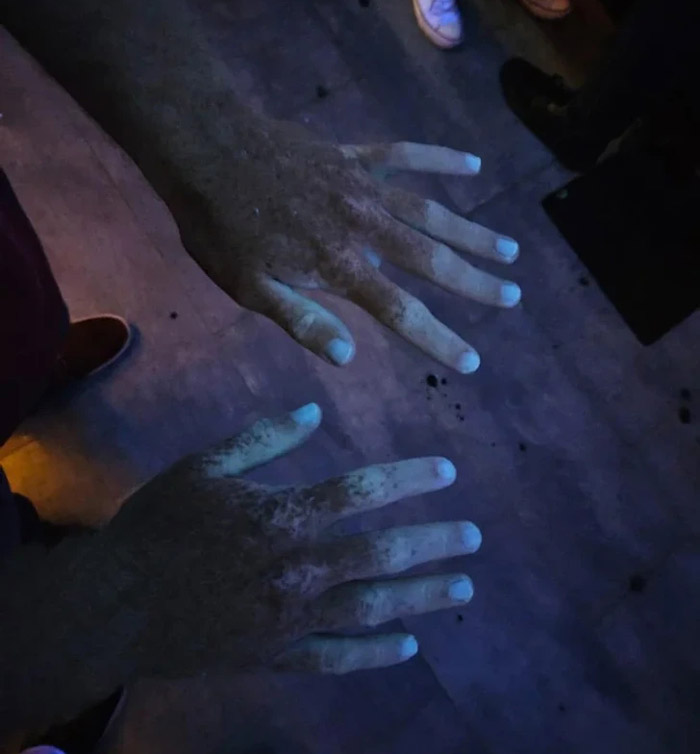 این فرد دستانش را زیر نور UV گرفته ، عکس های عجیب و غریب از ویژگی های منحصر به فرد ظاهری افراد