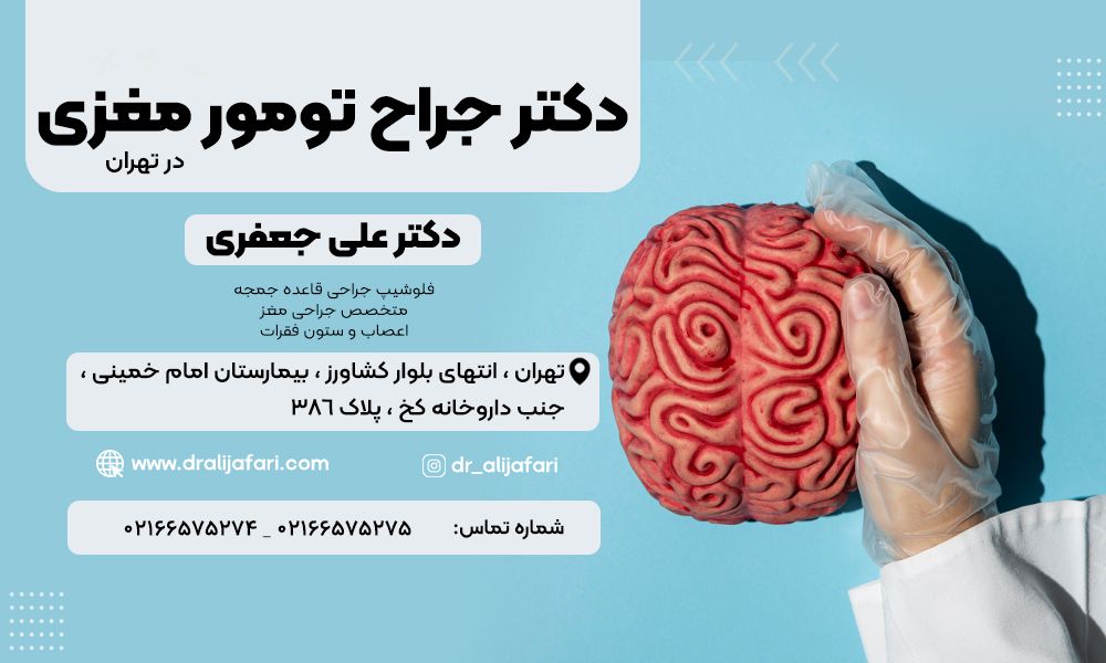 بهترین جراح تومور مغزی در تهران کیست؟