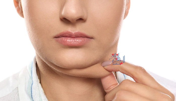 اگر غبغب دارید ، طالع بینی و شخصیت شناسی از روی چانه افراد