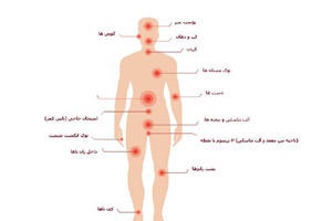 نقاط حساس بدن برای دفاع شخصی و نجات زندگی