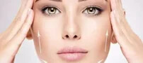 مقایسه بین لیفتینگ به وسیله نخ و لیفت ناحیه صورت به روش سنتی