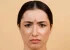 اخم کردن با چهره و پوست صورت ما چه می کند؟