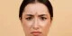 اخم کردن با چهره و پوست صورت ما چه می کند؟