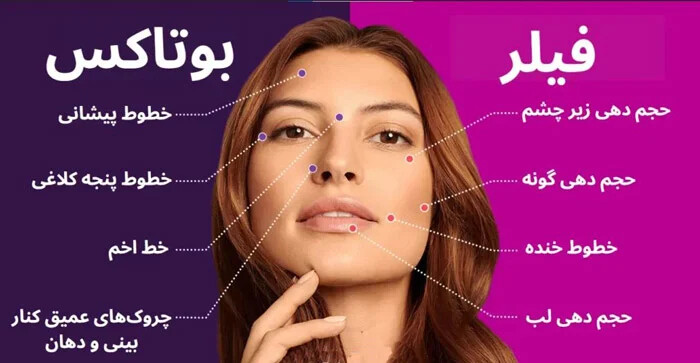 بین فیلر و بوتاکس کدام یک را انتخاب کنیم؟