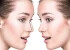 10 نوع جراحی بینی+ 4 نوع جراحی مربوط به بینی