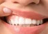 علائم هشدار دهنده لثه که حتما باید جدی بگیرید