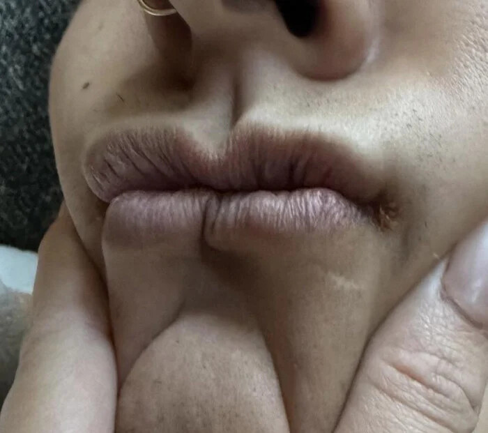 دو لبش به اندازه و متناسب همدیگر هستند ، عکس های جالب از اعضای عجیب و غریب بدن افراد!