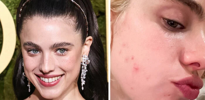 مارگارت کوالی (Margaret Qualley) ، بازیگران مشهوری که هنگام کار دچار سانحه شدند