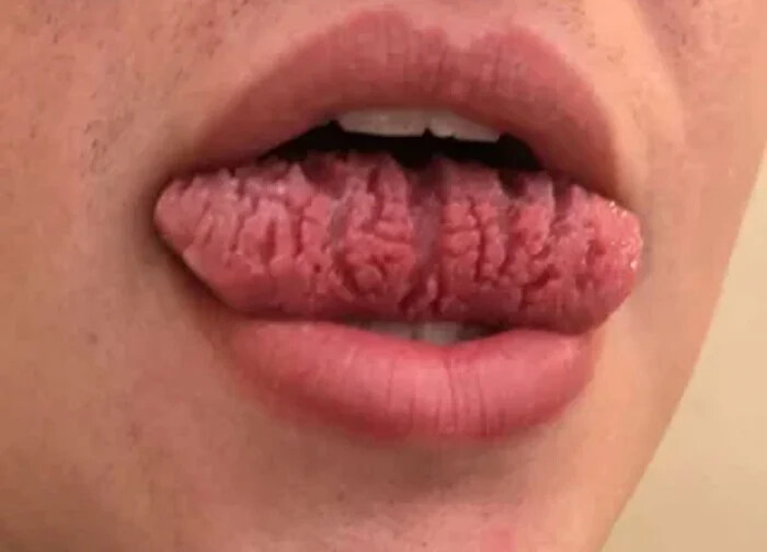 وضعیت ژنتیکی زبان ، عکس های جالب از وقتی ژنتیک غوغا به پا می کند
