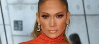 مصدومیت جنیفر لوپز (Jennifer Lopez) از ناحیه صورت
