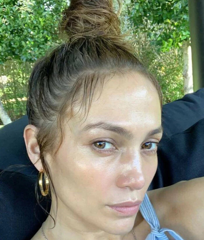 مصدومیت جنیفر لوپز (Jennifer Lopez) از ناحیه صورت