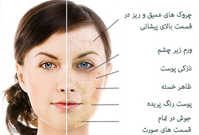 سرنخ های نامحسوس مشکلات سلامتی در صورت