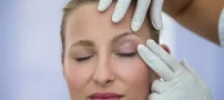 برای جراحی پلک به چه دکتری مراجعه کنیم؟