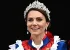 حاشیه های تغییر چهره کیت میدلتون (kate middleton)