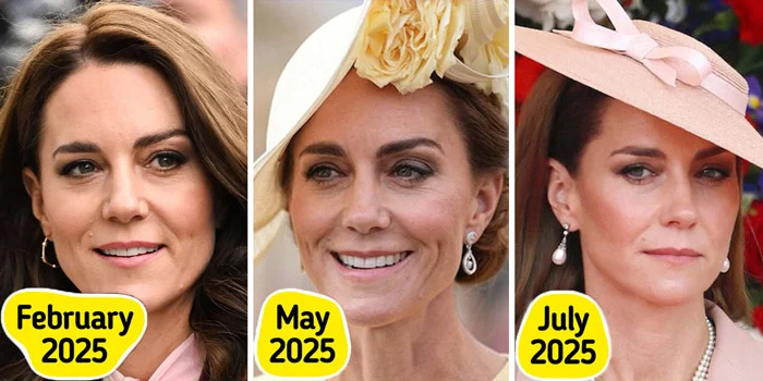حاشیه های تغییر چهره کیت میدلتون (kate middleton)