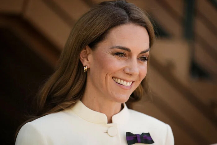 تصویر مربوط به جولای 2025 است ، حاشیه های تغییر چهره کیت میدلتون (kate middleton)