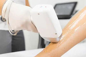 چگونه موهای زائد میتوانند باعث عرق و مشکلات پوستی شوند و راهکار چیست؟