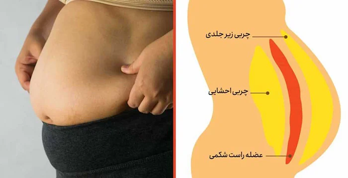 ورزش هایی برای کاهش چربی شکم بعد از 40 سالگی