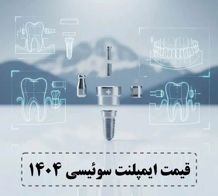 جدول قیمت بهترین برند ایمپلنت
